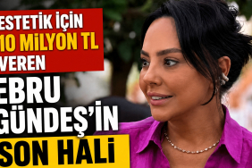 Estetik için 10 Milyon TL Veren Ebru Gündeş’in Son Hali Çok Konuşulacak!