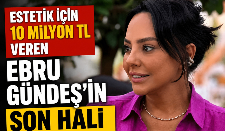 Estetik için 10 Milyon TL Veren Ebru Gündeş’in Son Hali Çok Konuşulacak!