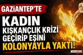 Gaziantep'te Kadın Kıskançlık Krizi Geçirip Eşini Kolonyayla Yaktı!