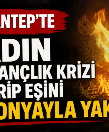 Gaziantep'te Kadın Kıskançlık Krizi Geçirip Eşini Kolonyayla Yaktı!