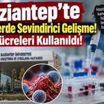 Gaziantep'te Kanserde Sevindirici Gelişme! NK Hücreleri Kullanıldı!